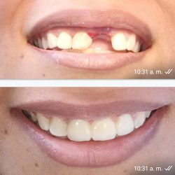 Dental Jezreel