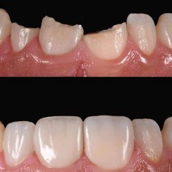 Dental La Joya E Implantes