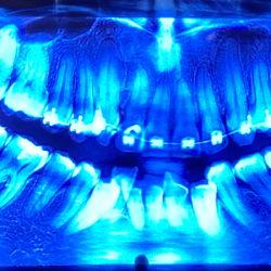 Dental Las Torres Minatitlán