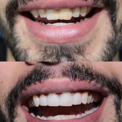 Dental Less