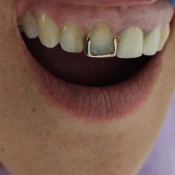 Dental Los Angeles