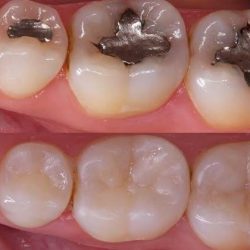 Dental Md