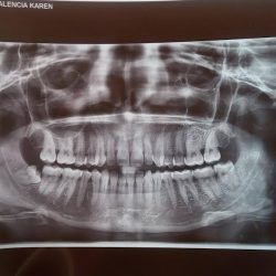 Dental Morlan