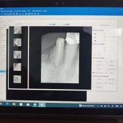 Dental Ms