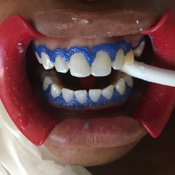 Dental Ola Odontologic Latino América-los Cabos