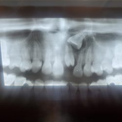 Dental Olinka