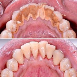 Dental Onepro