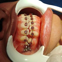 Dental Ortega