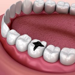 Dental Pass