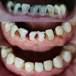 Dental Pm