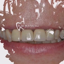 Dental Pro