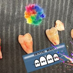 Dental Roed