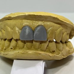 Dental Root