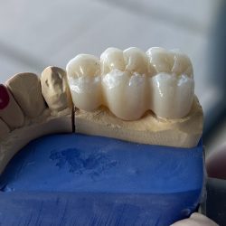 Dental Smalte