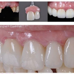 Dental St. Engracia.