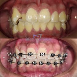 Dental Studio Campeche. Dentista En Campeche