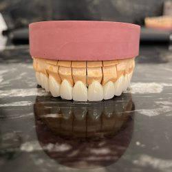 Dental Studio Fy Los Barriles