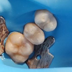 Dental Tecate