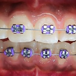 Dental Teotihuacan Dr Fer Vaca