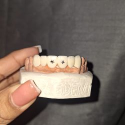 Dental Tere