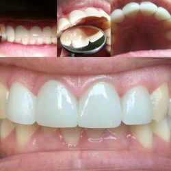 Dental Valencia