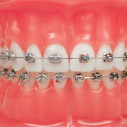 Dental Vasconcelos