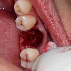 Dental Xer