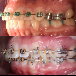 Dental Yv Orthodontics