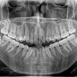 Dental Zas Odontología Y Ortodoncia Dra. Anahi