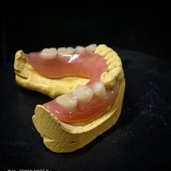 Dentalab Chapala Laboratorio Dental
