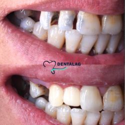 Dentalag