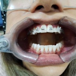 Dentalguz