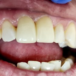 Dentall Donde Tu Sonrisa Es Una Realidad