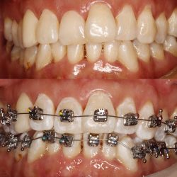 Dentalpro Sjr