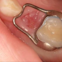 Dentalu
