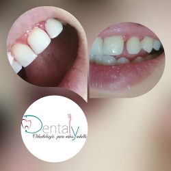 Dentaly