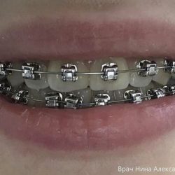 Dentestica Especialidades Odontológicas
