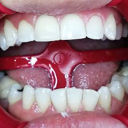 Denti-medic