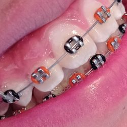 Dentilooks