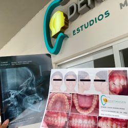 Dentimagen Estudios Maxilofaciales