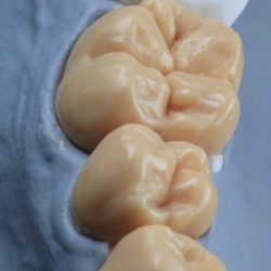 Dentinare Plus
