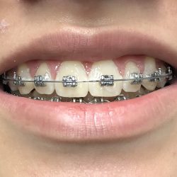 Dentis Consultorio Dental