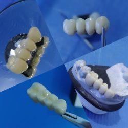 Dentista 24 Horas Dr.marco Vinicio Xalapa Urgencias Dentales