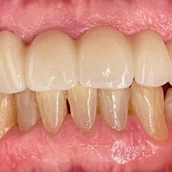 Dentista Alexa Patlán - Consultorio Dental