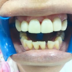 Dentista Anexo Farmacias Similares