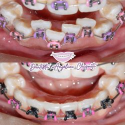 Dentista Angélica Chiquete