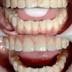 Dentista Apaseo El Grande