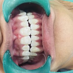 Dentista Benito Juarez