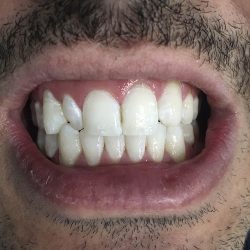 Dentista | C.o.p Dental. Dra. Mirna Gill