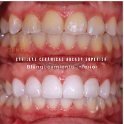 Dentista Cancún Hg Odontología Integral